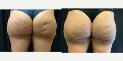 before and after image