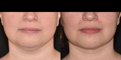 before and after image