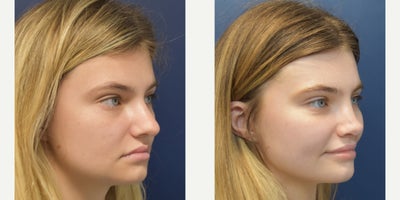 before and after image