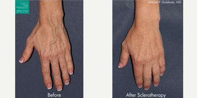 before and after image