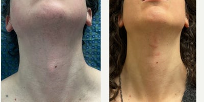 before and after image