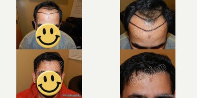 before and after image