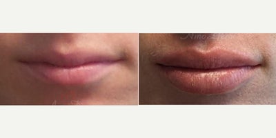 before and after image