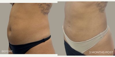 before and after image