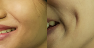 before and after image