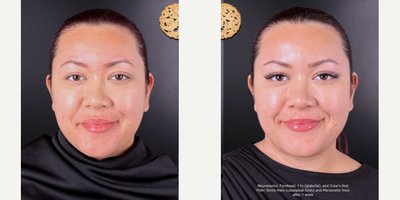 before and after image