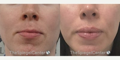 before and after image