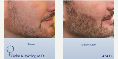 before and after image