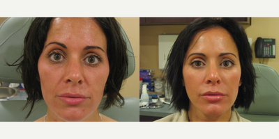 before and after image