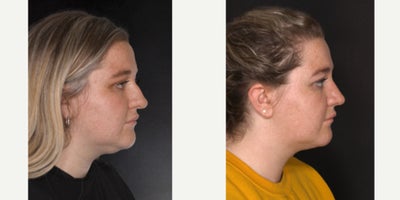 before and after image
