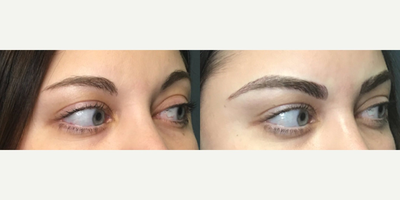 Microblading before and after photo