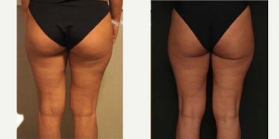 before and after image