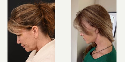 before and after image