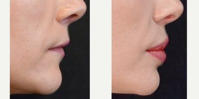 before and after image