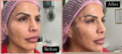 before and after image