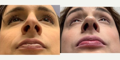 before and after image
