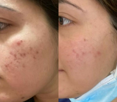 Clear and Brilliant before and after photo