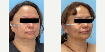 before and after image