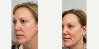 before and after image