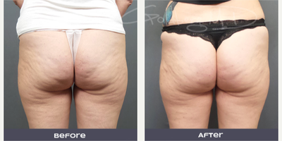 before and after image