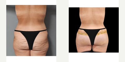 before and after image