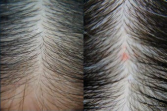 before and after image