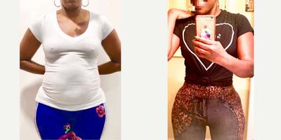 before and after image