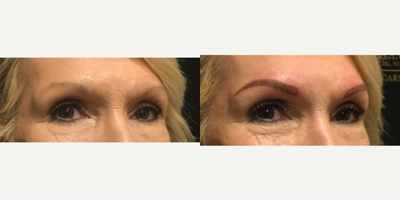 Microblading before and after photo