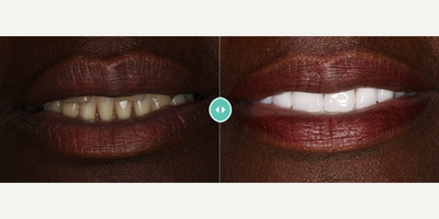 before and after image