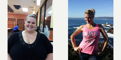 Gastric Bypass before and after photo