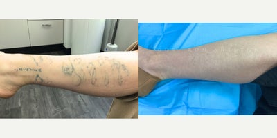 before and after image