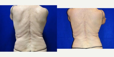 before and after image