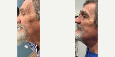 before and after image