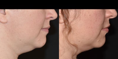before and after image