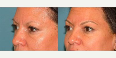 Microblading before and after photo