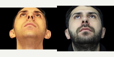 before and after image