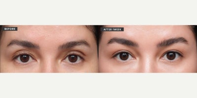 before and after image