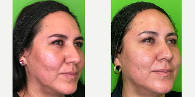 before and after image