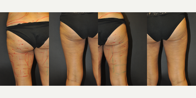 before and after image