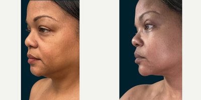 before and after image