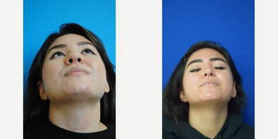 before and after image