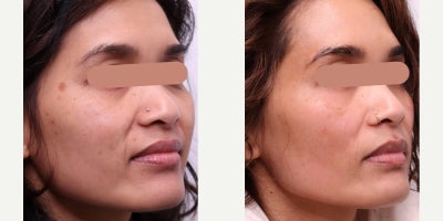 before and after image
