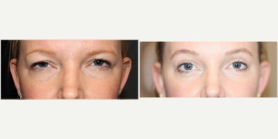 before and after image