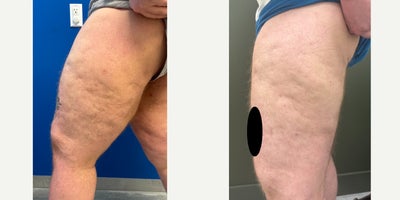 before and after image