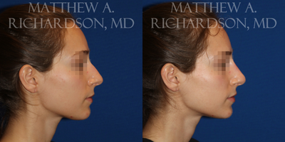 before and after image
