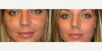 before and after image