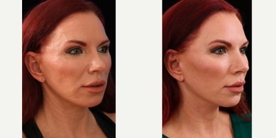 before and after image