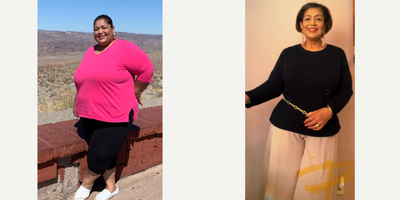 Gastric Sleeve Surgery before and after photo