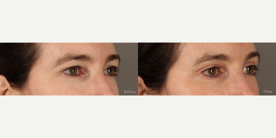 before and after image