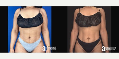 before and after image